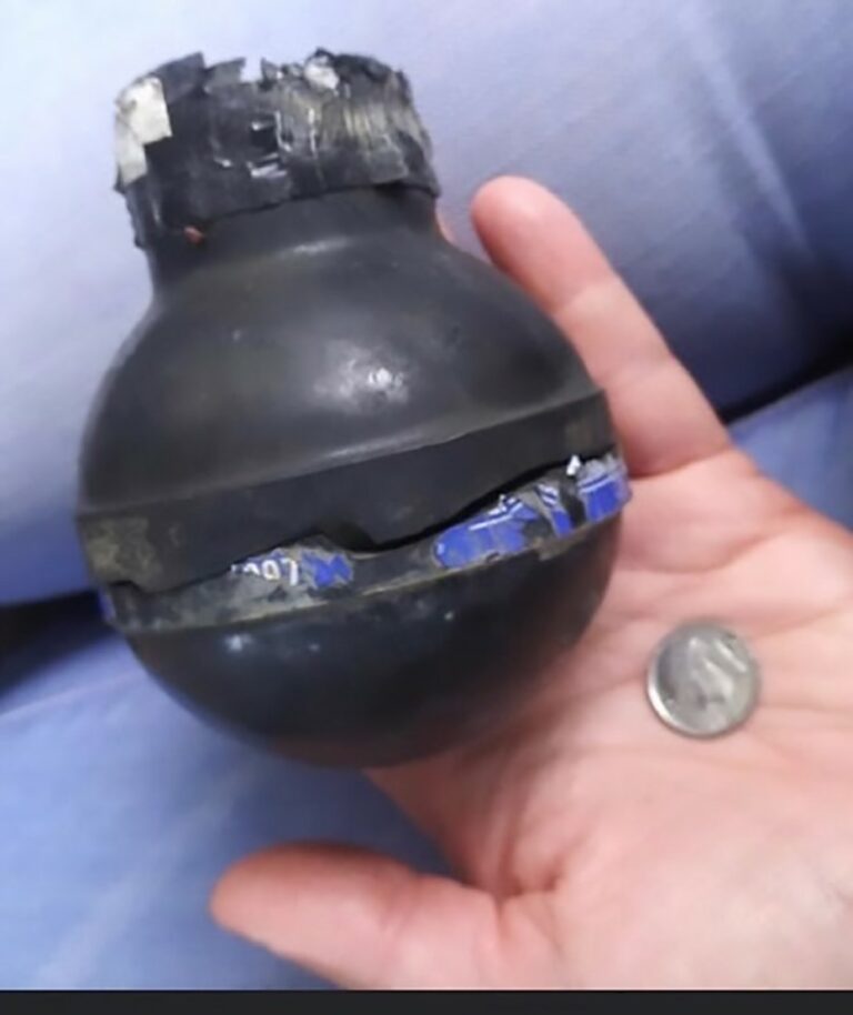 Man’s Jaw Fractured, Teeth Knocked Out By Law Enforcement During Protest